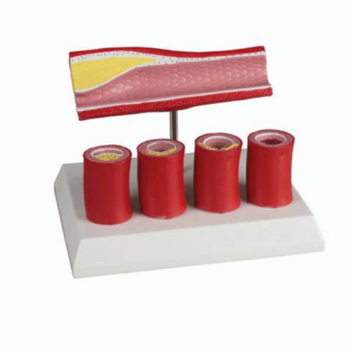 ERLER ZİMMER G240